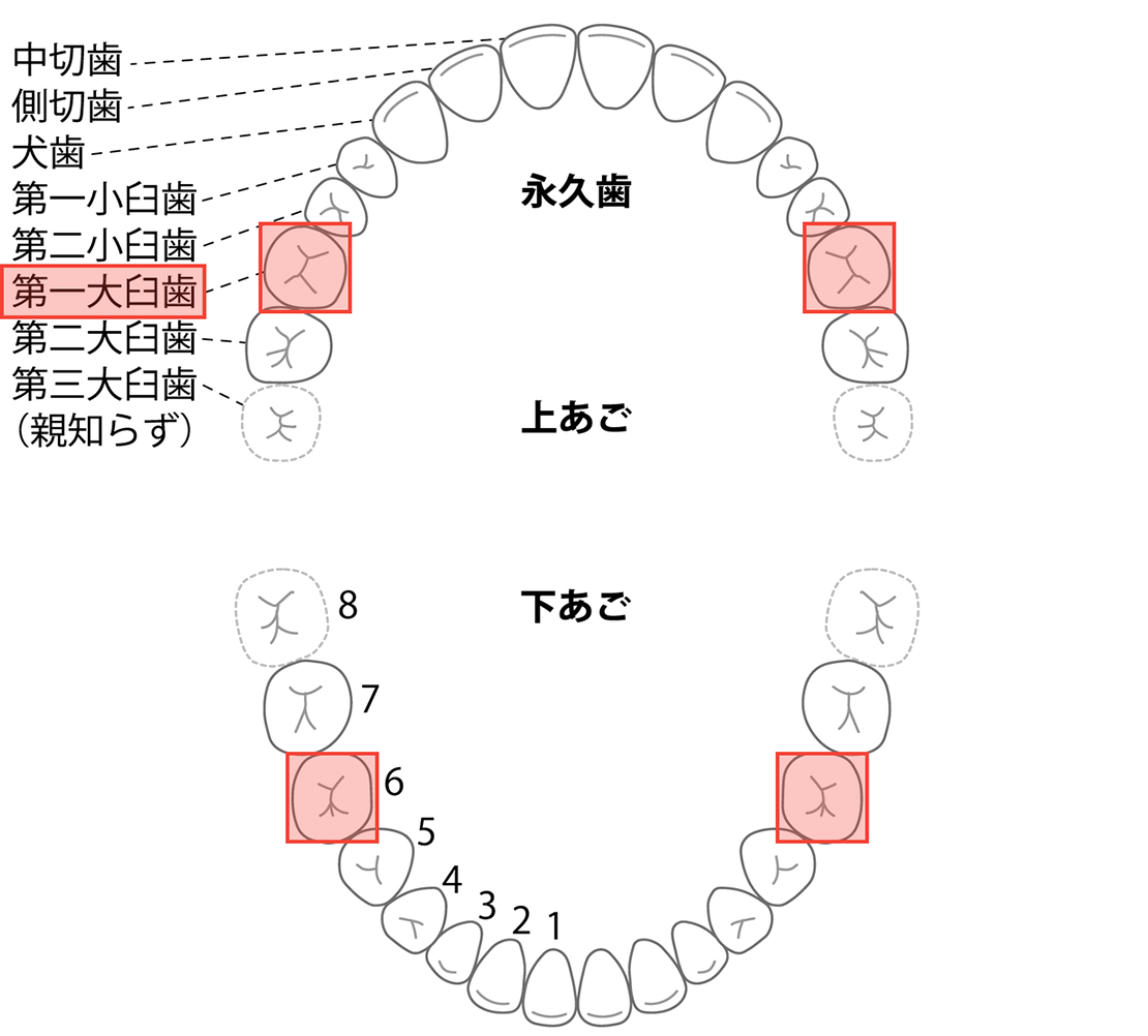 インビザラインファーストが可能な状態の第一期の歯列図